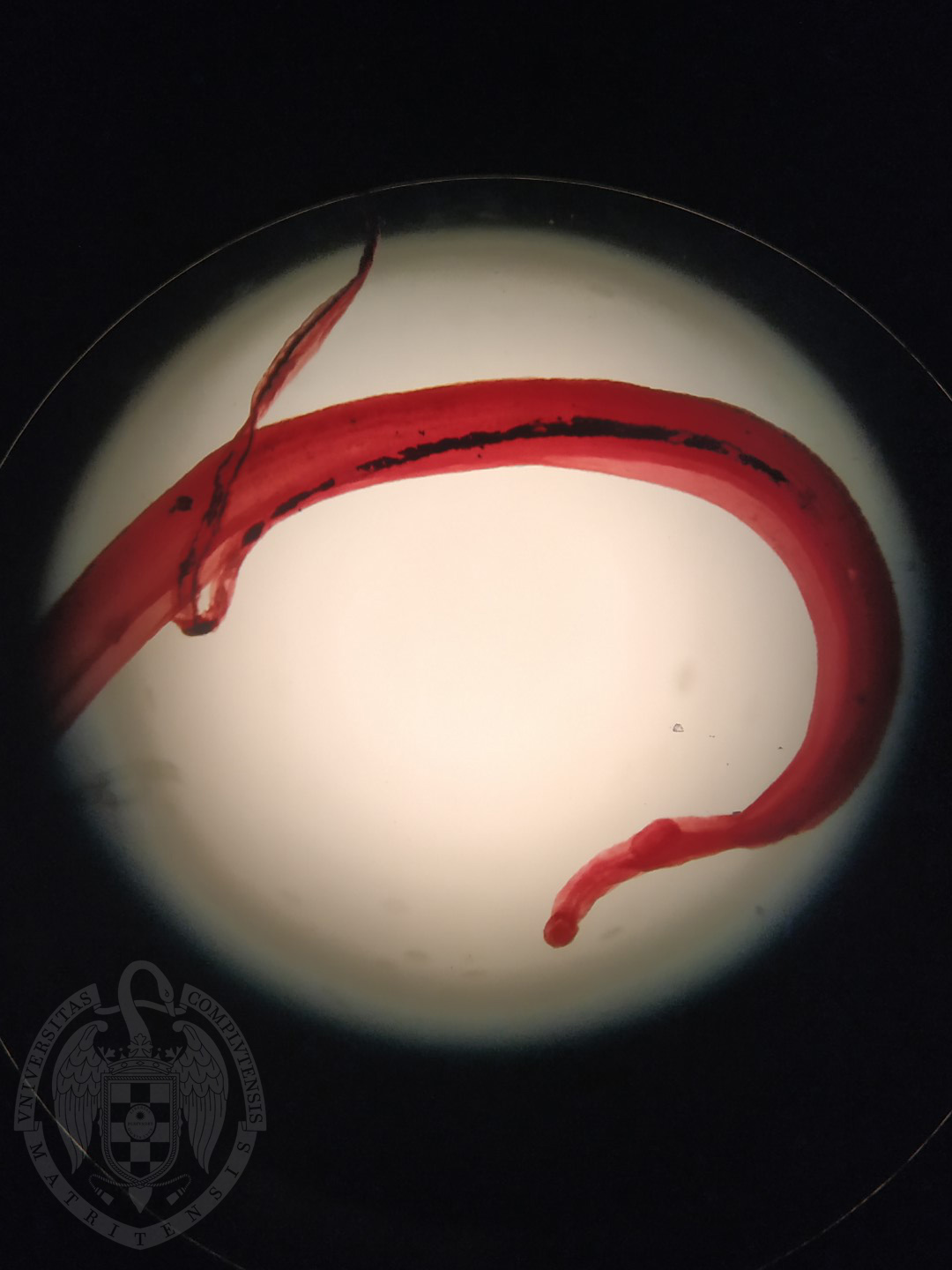 Schistosoma bovis